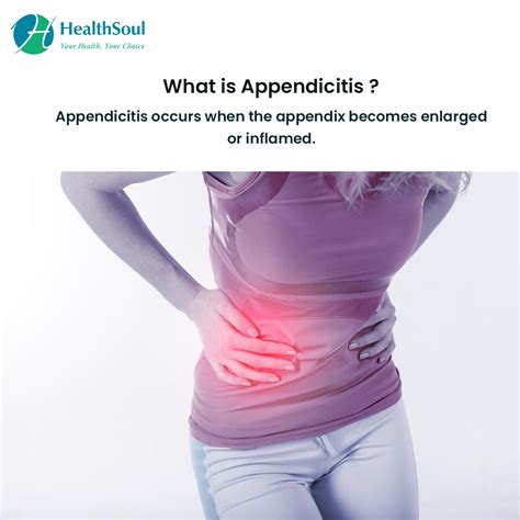 Appendicitis Common Cause Of Abdominal Pain In Young People Healthsoul
