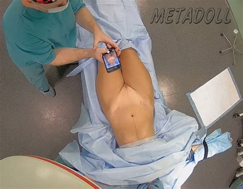 Voyeur Videos Metadoll Blog Perv Filmed Women Getting Naked During Operation Women During