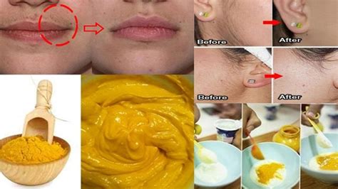 Home Remedies For How To Remove Face Hair Permanently At Home Naturally