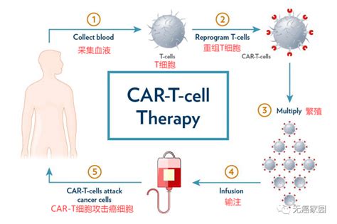 Car T细胞免疫疗法car T治疗让晚期癌症患者获得重生car T临床试验招募进行中全球肿瘤医生网