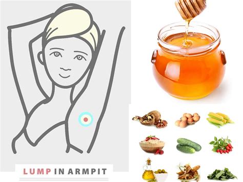 Painful Lump In Armpit Causes Symptoms And Natural Treatments