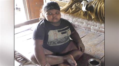 Bihar S 8 Years Old Girl Weighs 85 Kgs Know Her Shocking Story वनइंडिया हिन्दी Youtube
