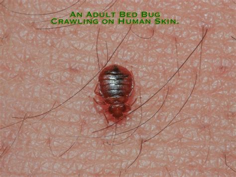 An Adult Bed Bug On Human Skin Mississauga Pest Control