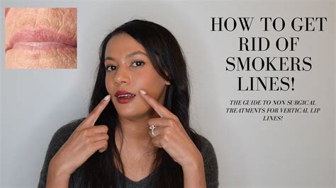 How To Get Rid Of Smokers Lines Lip Wrinkles And Vertical Lip Lines