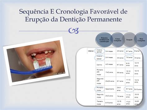 Cronologia Erupção Dentes Permanentes
