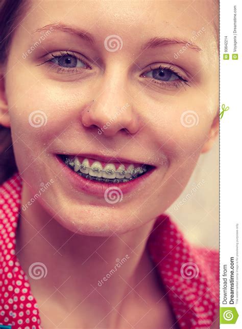 Woman Showing Her Teeth With Braces Stock Photo Image Of Enjoying