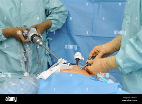 Prostate Surgery Stock Photo Alamy