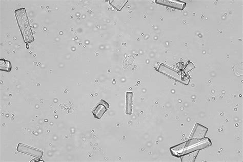 Urine sediment is normally almost cell free, is usually crystal free, and contains a very low concentration of protein (<1+ by dipstick). SediVue Dx Veterinary Urine Sediment Analyser - IDEXX ...