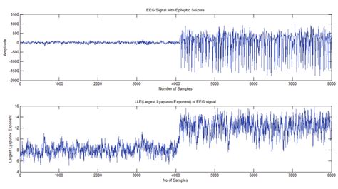 Eeg Signal With Epileptic Seizure And Its Corresponding Largest