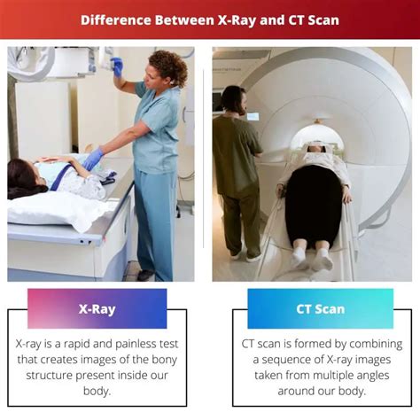 X Ray Vs Ct Scan Difference And Comparison