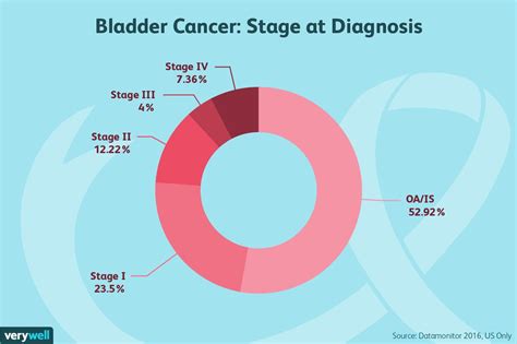 How Bladder Cancer Is Treated