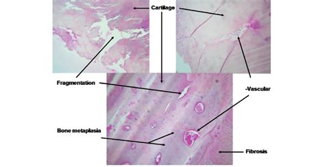 histological analysis of explanted costal cartilage download scientific diagram
