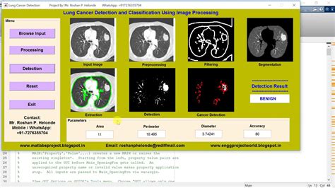 Lung Cancer Detection And Classification Using Image Processing Final Year Project Youtube