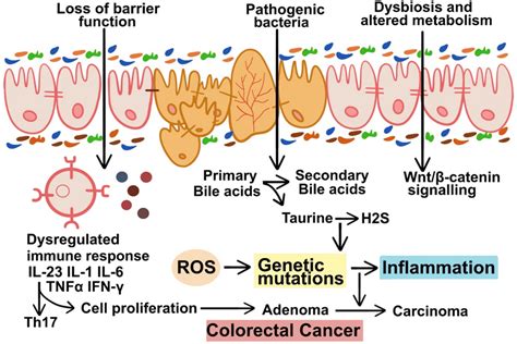 Possible Roles Of Gut Microbiota In Crc Causation Gut Microbiota Can