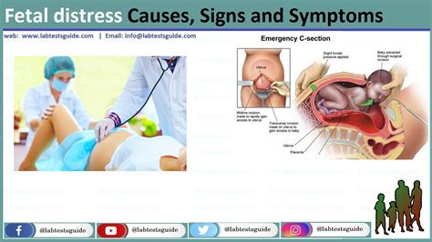 Fetal Distress Causes Symptoms Diagnosis And Management