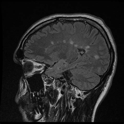 Simple Science: How to Make a Volcano with Kids