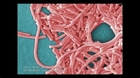 As part of our legionella pneumophila is a bacterium that can cause a disease known as legionellosis or legionnaires' disease (ld). Legionnaires' Disease: What You Need to Know - YouTube