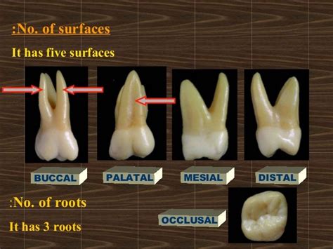 5 Maxillary First Molar