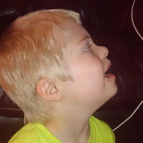 Parents around the world would be delighted to have archie harrison as the face of children with congenital disabilities. Our Special Little Lincoln: a closer look