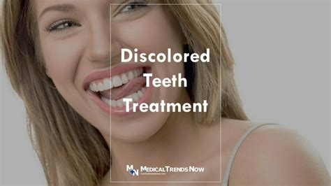 Teeth Discoloration The Causes And What You Can Do About It Medical