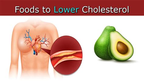 10 Foods To Lower Your Cholesterol Womenworking