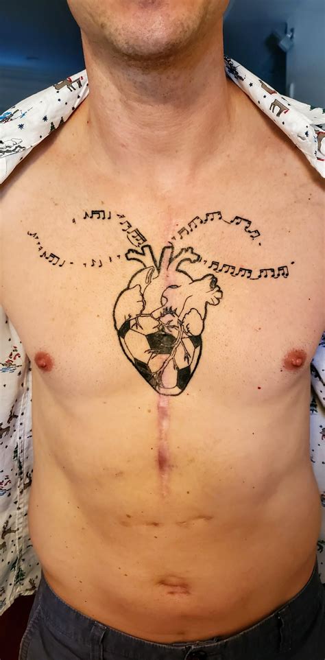 Can You Get A Tattoo After Open Heart Surgery Irucve