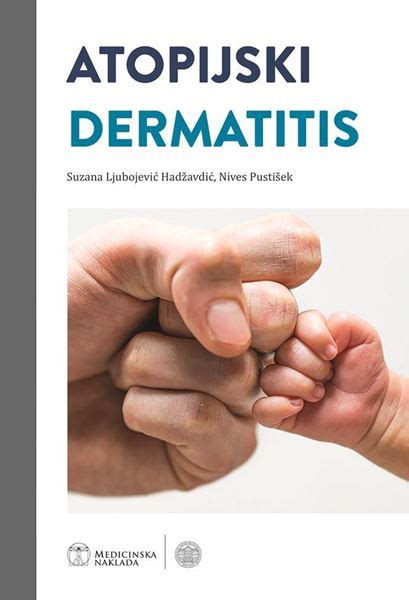 Atopijski dermatitis by Suzana Ljubojević Hadžavdić Goodreads