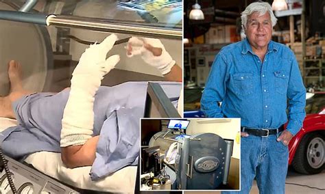Jay Leno Is Seen With Bandaged Hands And Arms In Hyperbaric Chamber As