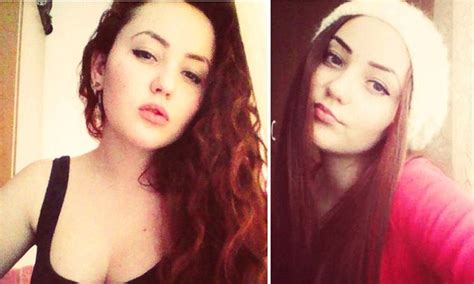 Selfie Obsessed Romanian Teen Burst Into Flames When She Free