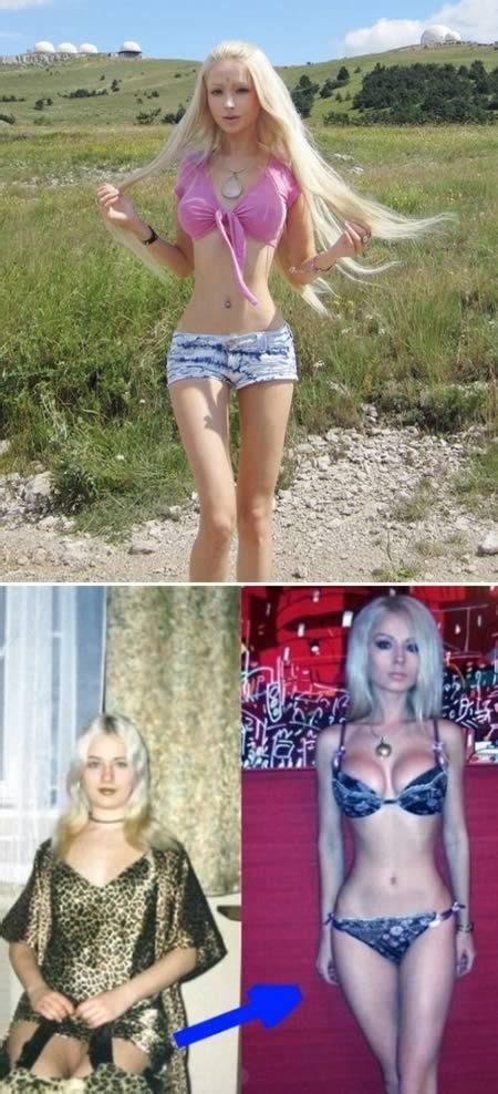 The Russian Barbie Who Supposedly Had Her Ribs Removed To Have A
