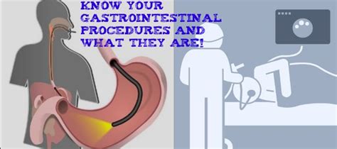 Know Your Gastrointestinal Procedures And What They Are Knowing You