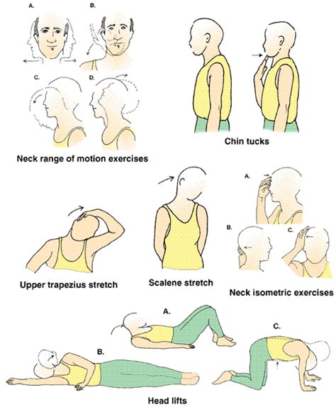 Cervical Disc Herniation Causes Symptoms Diagnosis And Treatment How