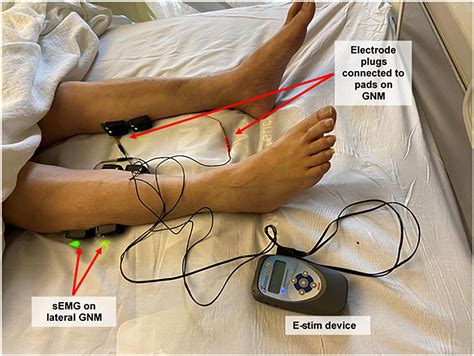 Frontiers Safety And Efficacy Of Electrical Stimulation For Lower