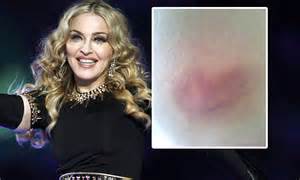 Madonna Shows Off Heart Shaped Bruise On Her Bare Derriere As She Posts
