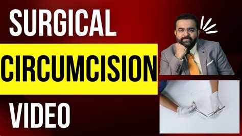 How To Do Classic Circumcision With Stitches Freehand Method Dr Kuber MS Call