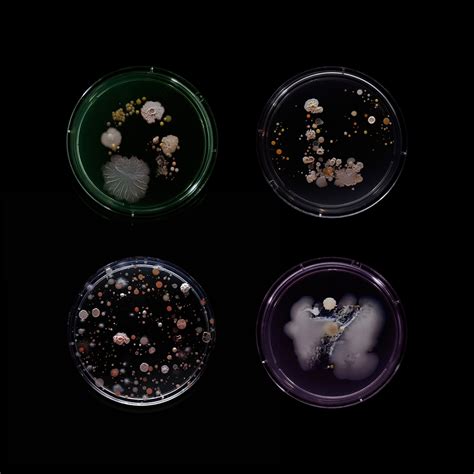 Photographer Transforms Bacteria Found On The New York City Subway Into