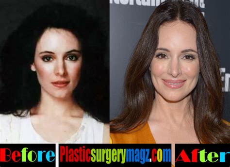 Madeleine Stowe Plastic Surgery Before And After Plastic Surgery