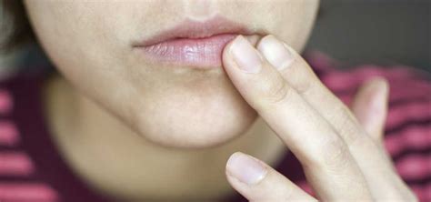 What Causes Dark Spots On Lips Dessert Laboc
