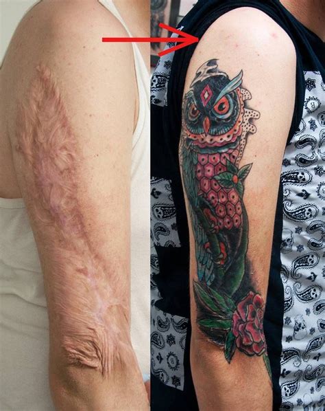Two Photos Side By Side One With A Scarp And The Other With A Tattoo On It