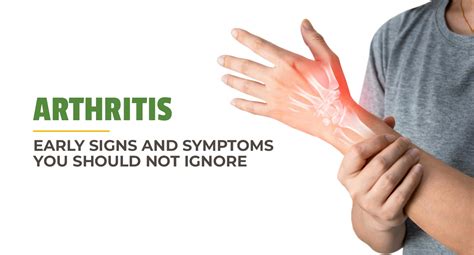 Arthritis Early Signs And Symptoms You Should Not Ignore