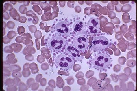 What Do Platelets Show Whtoda