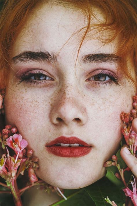 Facts About Freckles Weird Things About Freckles