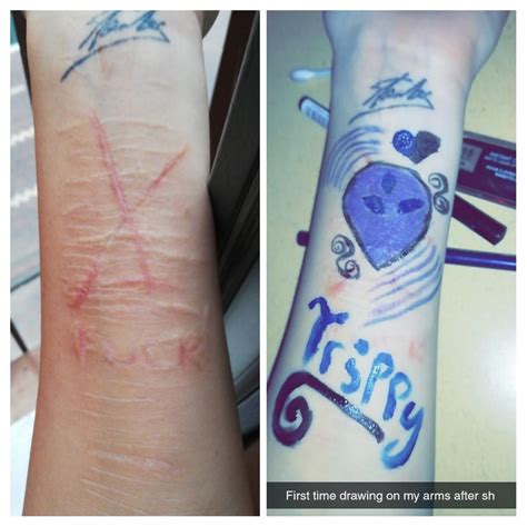 Scars Are 3 Months Healed Rediscovered How Fun It Is To Draw On My