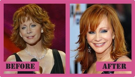 reba mcentire plastic surgery before and after reba mcentire plastic surgery re mcentire