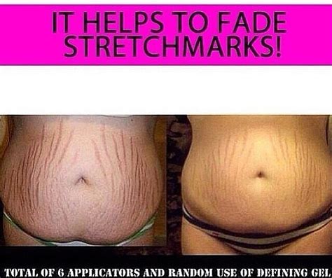 How To Firm Your Skin And Reduce Stretch Marks Also How Make Your Tattoos Look Brand New Musely