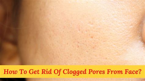 How To Get Rid Of Clogged Pores From Face Treatments And Prevention