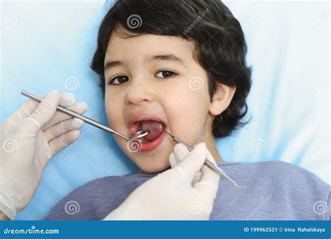 Cute Arab Boy Sitting At Dental Chair With Open Mouth During Oral