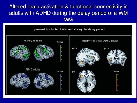 Neurobiology is a scientific field in which researchers study the nervous system and brain function. PPT - Class # 3: Neurobiology of ADHD PowerPoint ...