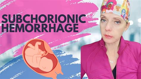 What Is A Subchorionic Hemorrhage Or Hematoma Youtube