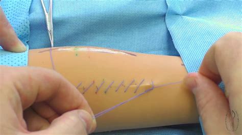Continuous Blanket Suture Making Technique Over And Over Continuos